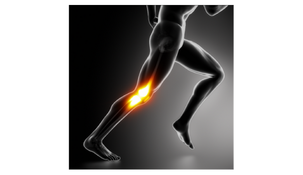 X-ray illustration of a runner with knee injury highlighted