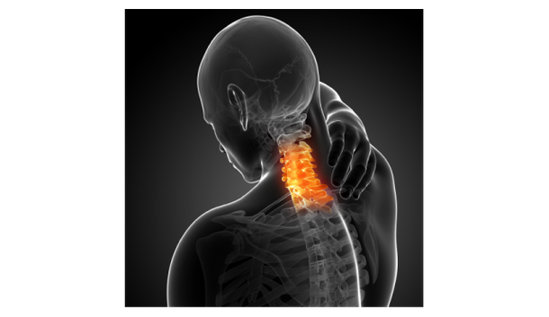 X-ray illustration of cervical spine with inflammation highlighted