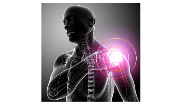 X-ray illustration of a shoulder joint with the rotator cuff area highlighted