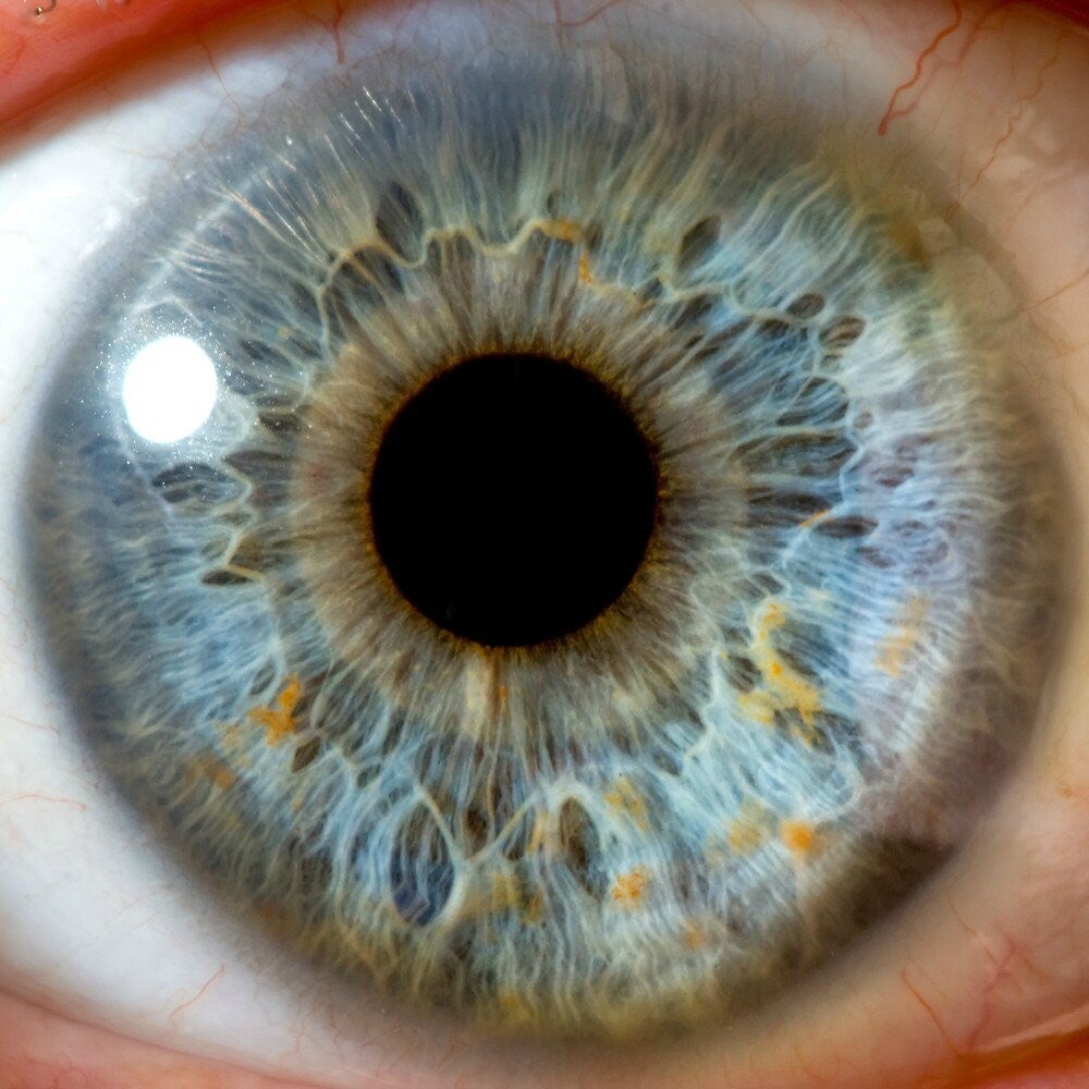 Macro photograph of a human iris, the focus of iridology analysis