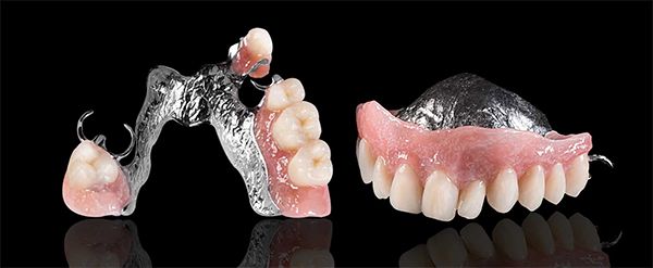 Cast metal partials crafted at London West Denture Clinic