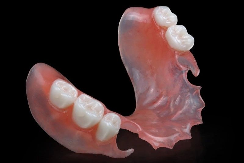Flexible partials crafted at London West Denture Clinic