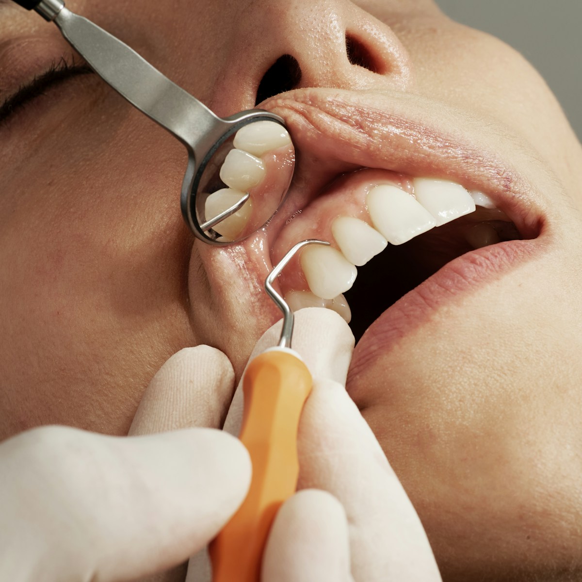 A dental office scene