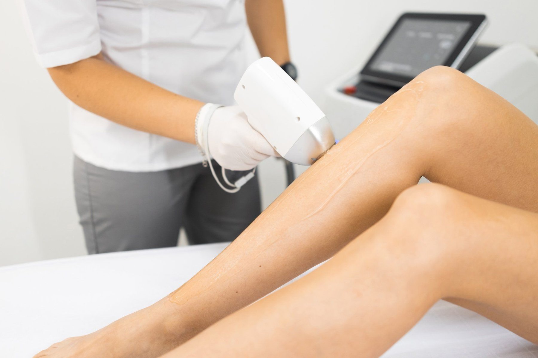 Laser hair removal session