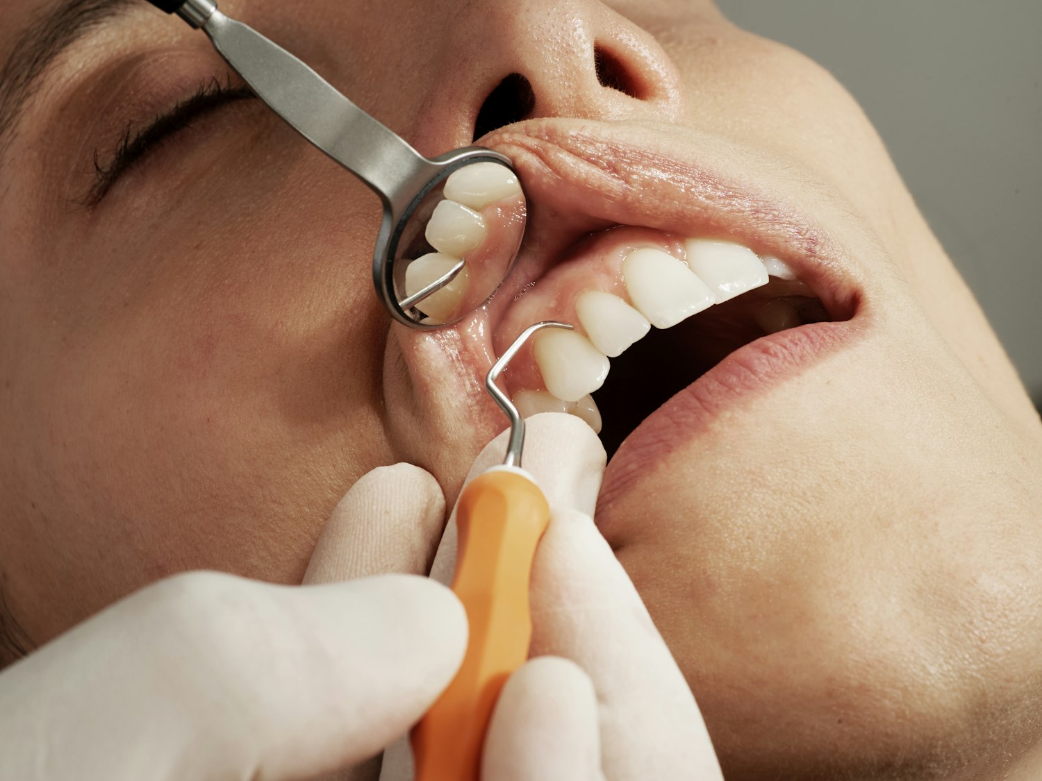 A dentist caring for a patient at Spencer Dentistry in London Ontario